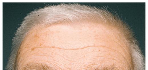 Старение кожи в зависимости от расы